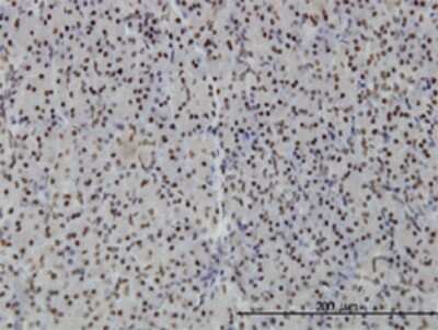 Immunohistochemistry-Paraffin: PTRF Antibody (1F7) [H00284119-M02]