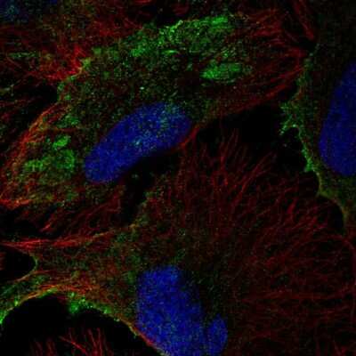 Immunocytochemistry/ Immunofluorescence: PTRF Antibody [NBP2-57490]