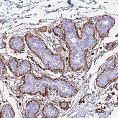 Immunohistochemistry-Paraffin: PTRF Antibody [NBP2-13828]