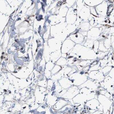 Immunohistochemistry-Paraffin: PTRH1 Antibody [NBP1-86713]