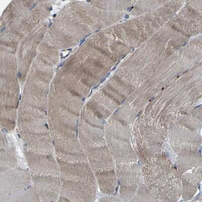Immunohistochemistry-Paraffin: PTRH2 Antibody [NBP1-88595]