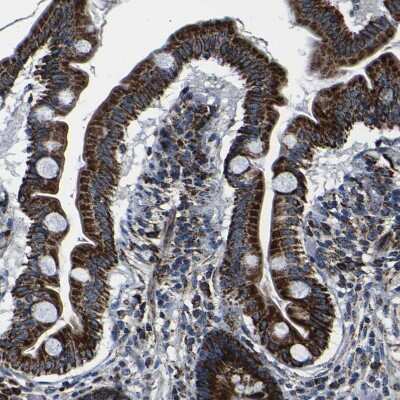 Immunohistochemistry-Paraffin: PTRH2 Antibody [NBP1-88595]
