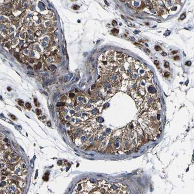 Immunohistochemistry-Paraffin: PTRH2 Antibody [NBP1-88595]