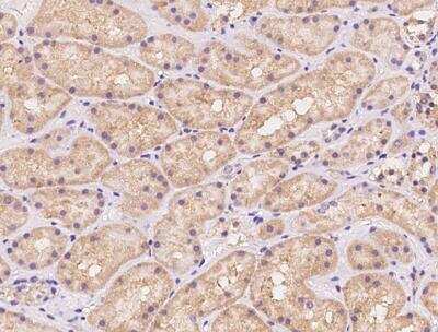 Immunohistochemistry-Paraffin: PTRH2 Antibody [NBP3-12579]