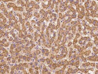 Immunohistochemistry-Paraffin: PTRH2 Antibody [NBP3-12579]