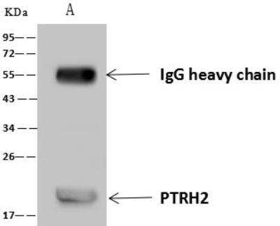 Immunoprecipitation: PTRH2 Antibody [NBP3-12579]