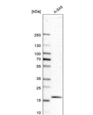 Western Blot: PTRH2 Antibody [NBP1-88595]