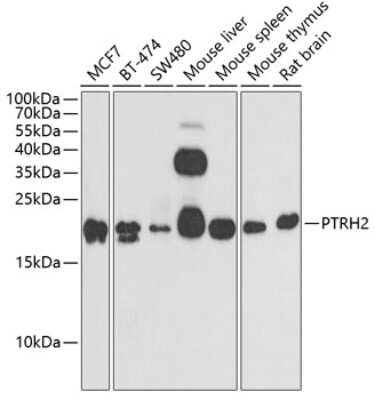 Western Blot: PTRH2 AntibodyBSA Free [NBP2-94026]