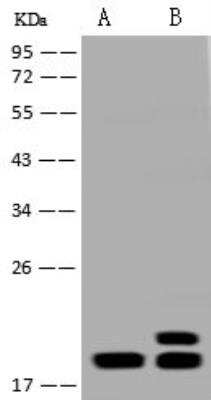 Western Blot: PTRH2 Antibody [NBP3-12579]