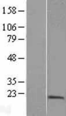 Western Blot: PTRH2 Overexpression Lysate [NBL1-14990]