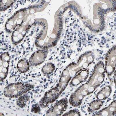 Immunohistochemistry-Paraffin: PTRHD1 Antibody [NBP1-93543]