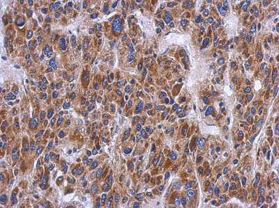 Immunohistochemistry-Paraffin: PTS Antibody [NBP1-32975]