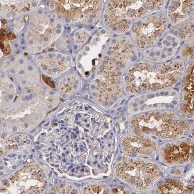 Immunohistochemistry-Paraffin: PTS Antibody [NBP1-87187]