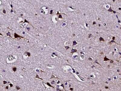 Immunohistochemistry-Paraffin: PTS Antibody [NBP3-00276]