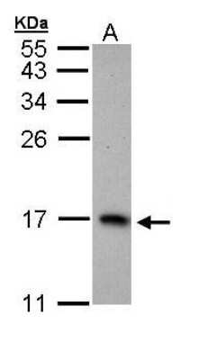 Western Blot: PTS Antibody [NBP1-32975]