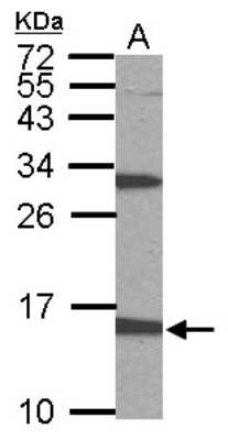 Western Blot: PTS Antibody [NBP1-32975]