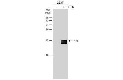 Western Blot: PTS Antibody [NBP1-32975]