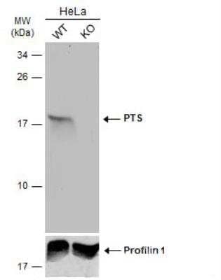 Western Blot: PTS Antibody [NBP1-32975]