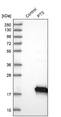 Western Blot: PTS Antibody [NBP1-87187]