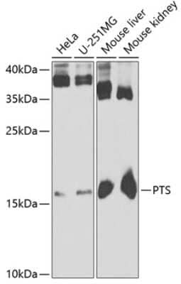 Western Blot: PTS AntibodyBSA Free [NBP2-93782]