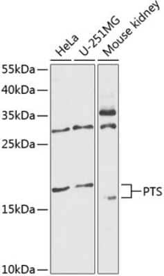 Western Blot: PTS AntibodyBSA Free [NBP2-94788]