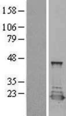 Western Blot: PTS Overexpression Lysate [NBL1-14991]