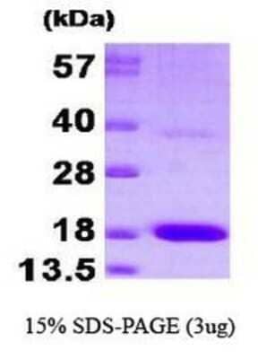 SDS-PAGE: Recombinant Human PTS His Protein [NBP1-37071]