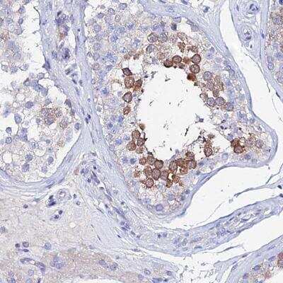 Immunohistochemistry-Paraffin: PTTG1 Antibody [NBP2-46709]