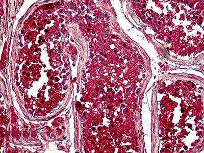 Immunohistochemistry-Paraffin: PTTG1 Antibody [NBP2-69985]
