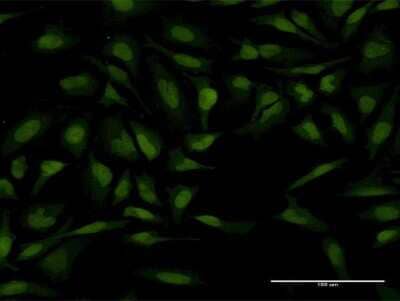 Immunocytochemistry/ Immunofluorescence: PTTG1 Antibody (1G10) [H00009232-M21]