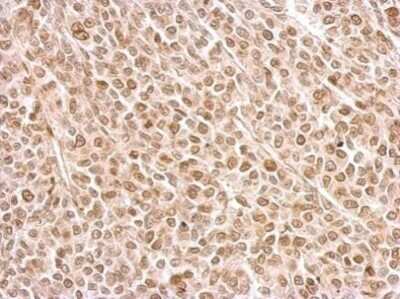 Immunohistochemistry-Paraffin: PTTG1 Antibody [NBP2-20287]