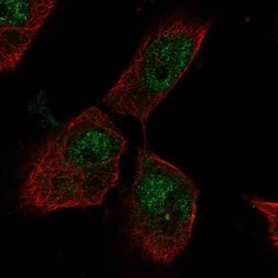 Immunocytochemistry/ Immunofluorescence: PTTG1IP Antibody [NBP2-57370]