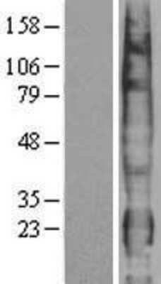 Western Blot: PTTG1IP Overexpression Lysate [NBP2-04271]