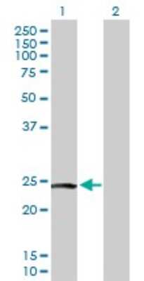 Western Blot: PTTG2 Antibody [H00010744-D01P]