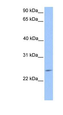 Western Blot: PTTG2 Antibody [NBP1-79377]