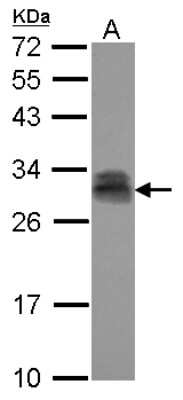 Western Blot: PTTG2 Antibody [NBP2-20006]