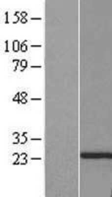 Western Blot: PTTG2 Overexpression Lysate [NBP2-07603]