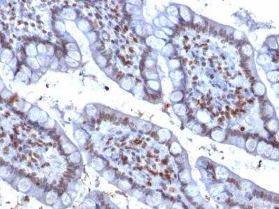 Immunohistochemistry-Paraffin: PU.1/Spi-1 Antibody (PU1/2146) - Azide and BSA Free [NBP2-75766]