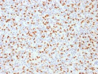 Immunohistochemistry-Paraffin: PU.1/Spi-1 Antibody (PU1/2146) - Azide and BSA Free [NBP2-75766]