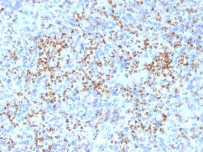 Immunohistochemistry-Paraffin: PU.1/Spi-1 Antibody (PU1/2146) - Azide and BSA Free [NBP2-75766]