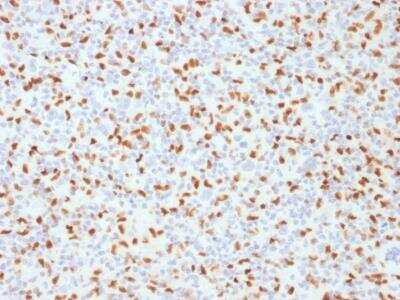 Immunohistochemistry-Paraffin: PU.1/Spi-1 Antibody (PU1/2146) [NBP2-75738]