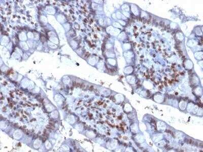 Immunohistochemistry-Paraffin: PU.1/Spi-1 Antibody (PU1/2146) [NBP2-75738]