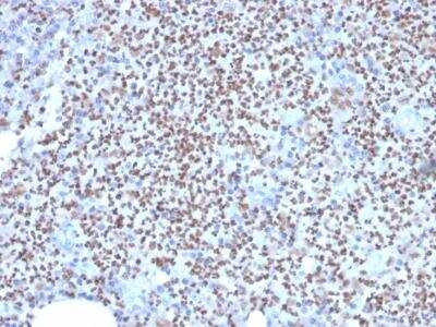 Immunohistochemistry-Paraffin: PU.1/Spi-1 Antibody (PU1/2146) [NBP2-75738]