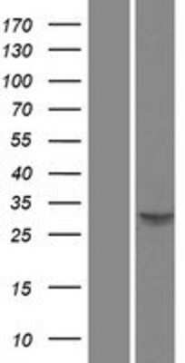 Western Blot: PU.1/Spi-1 Overexpression Lysate [NBP2-10658]