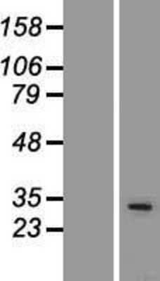 Western Blot: PU.1/Spi-1 Overexpression Lysate [NBP2-10869]