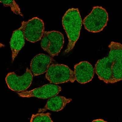 Immunocytochemistry/ Immunofluorescence: PU.1/Spi-1 Antibody [NBP2-33427]