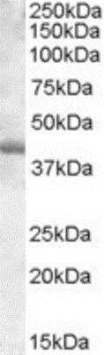 Western Blot: PU.1/Spi-1 Antibody [NBP1-00135]