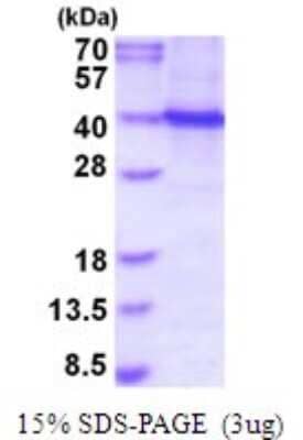 SDS-PAGE: Recombinant Human PU.1/Spi-1 His Protein [NBP2-51976]