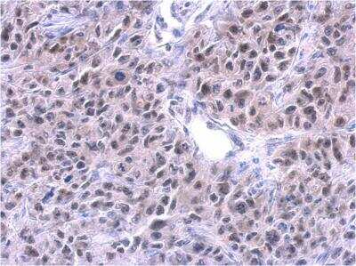 Immunohistochemistry-Paraffin: PUF60 Antibody (3510) [NBP2-43835]