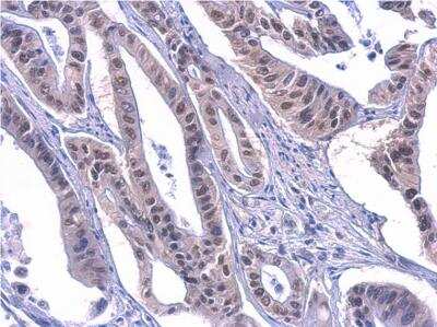 Immunohistochemistry-Paraffin: PUF60 Antibody (3510) [NBP2-43835]